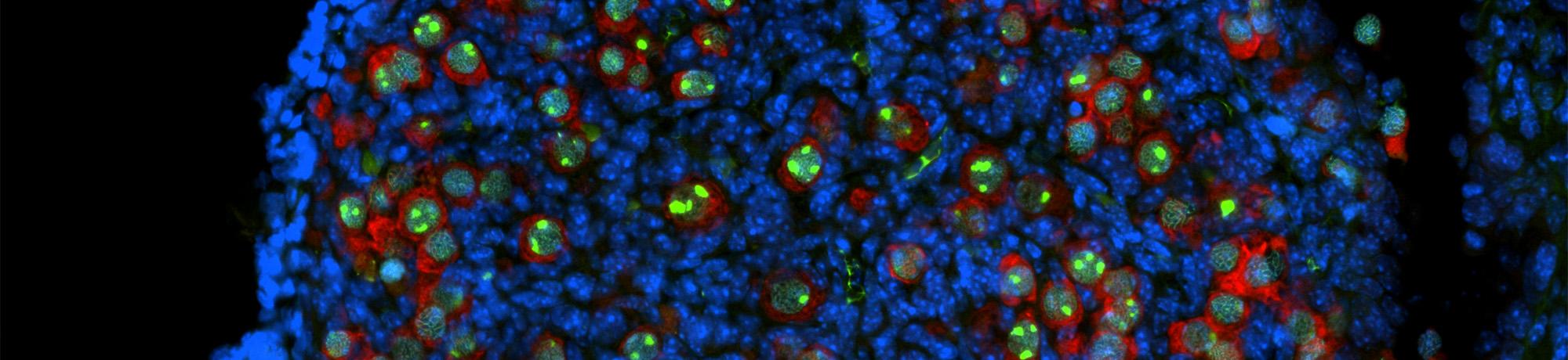 Fluorescent micrograph: cell spheroid with blue nuclei, red cytoplasm, green spots.