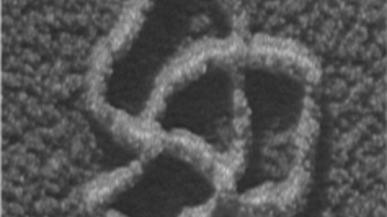 DNA knot as seen under the electron microscope