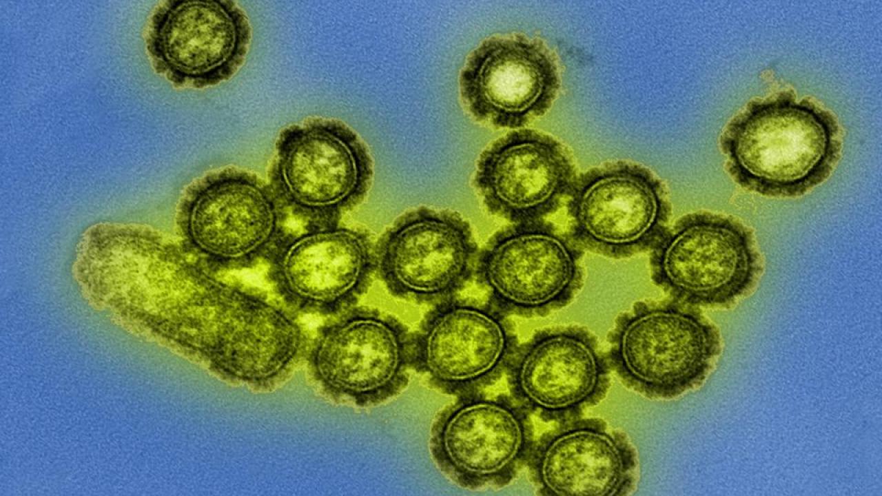 H1N1 influenza particles