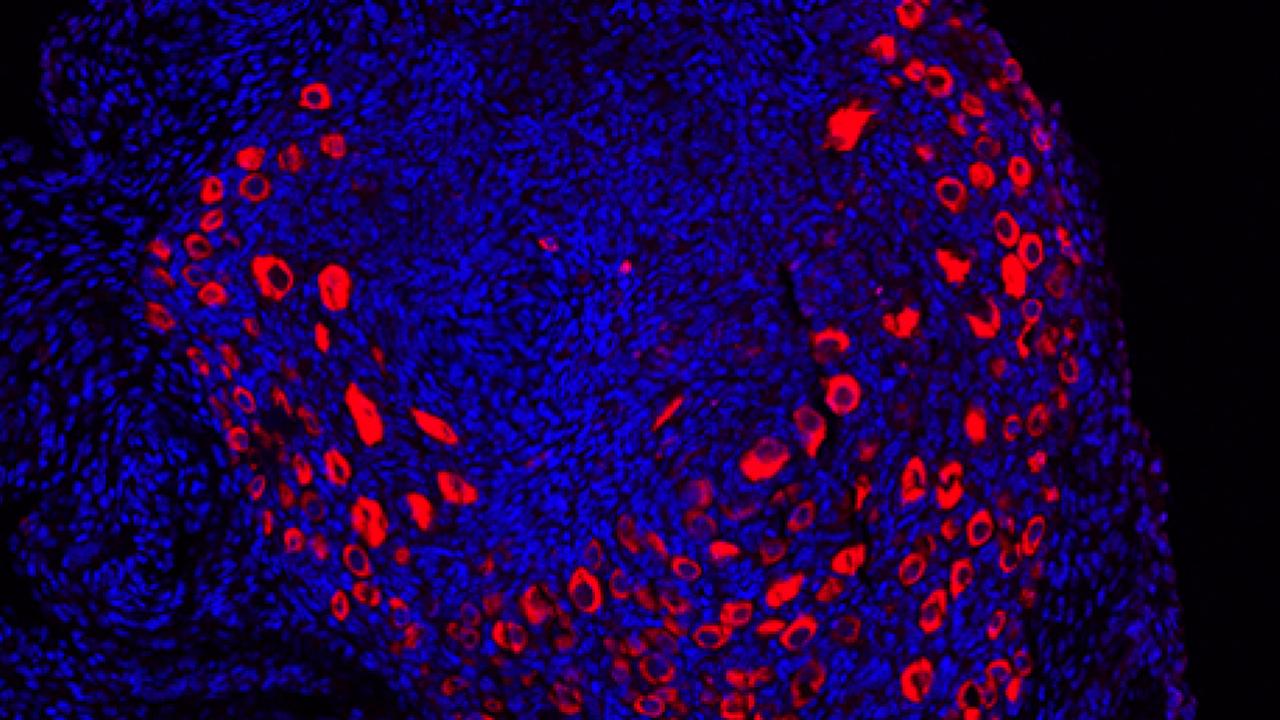 A section of mouse ovary; oocytes were immunostained with a germ cell marker, DDX4.