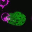Fluorescent microscopy image showing a green-colored Entamoeba histolytica parasite in contact with several magenta-colored circular human T-cells, illustrating the parasite’s attack on immune cells.