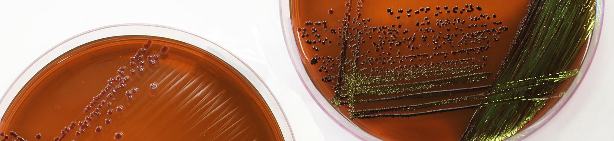 Blood agar plate